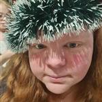 Blundaochduskafåse
